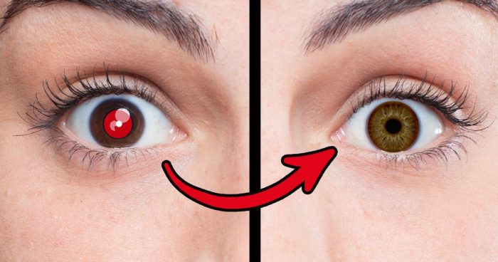 Best Red Eye Removal Apps